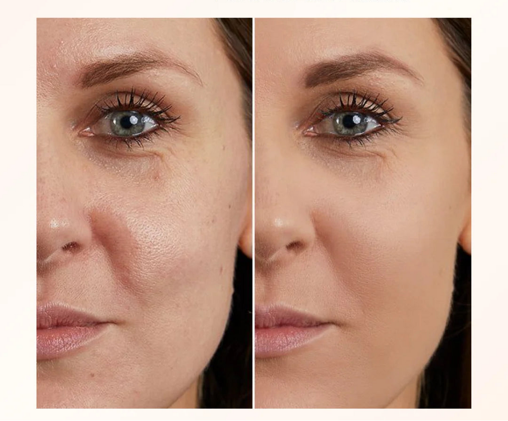 Before and after comparison of a woman's face with text about TLM solution.
