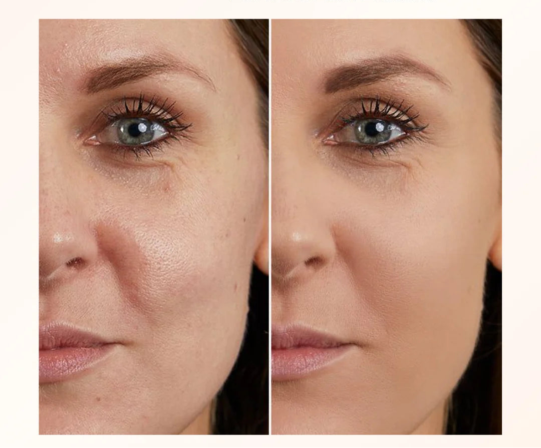 Before and after comparison of a woman's face with text about TLM solution.
